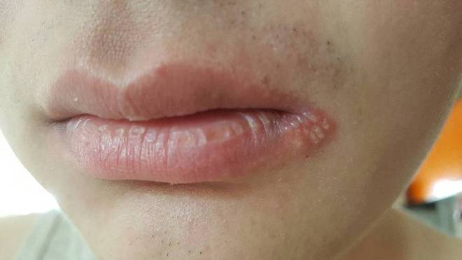 医生强调：早上经常吃鸡蛋的老人过不了多久身体或有4个改变(图7)